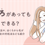 ほくろがあっても脱毛はできる？ほくろから毛が生えている場合の脱毛方法についても解説