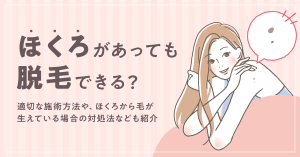ほくろがあっても脱毛はできる？ほくろから毛が生えている場合の脱毛方法についても解説