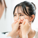 二重埋没法の抜糸について。必要なの？いつするの？を解説