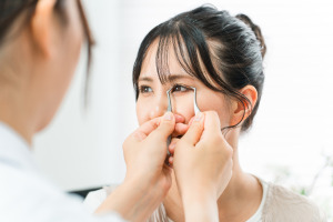 二重埋没法の抜糸について。必要なの？いつするの？を解説